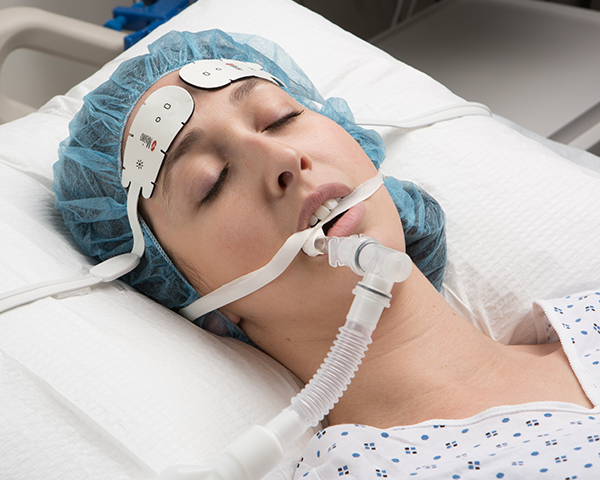 Patient endormi et intubé portant une blouse d’hôpital et un bonnet chirurgical, surveillé par un capteur de front Masimo