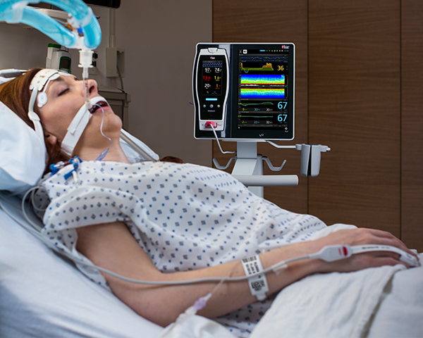 Un patient sous surveillance avec les dispositifs SedLine et O3 sur le Root en USPA