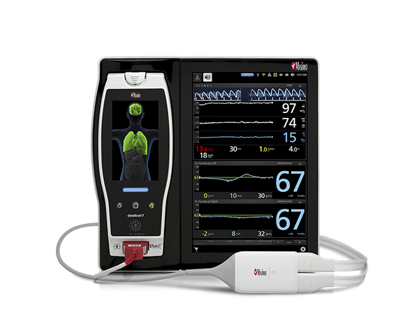 Photo du produit Root avec oxymétrie régionale O3