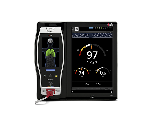 Moniteur patient Root avec Radical-7 branché.