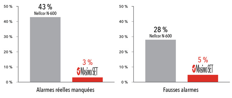 Masimo - Performance en présence de mouvements et d’une perfusion faible