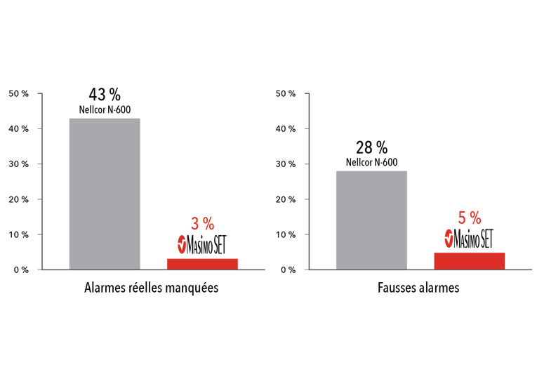 Masimo - Performance à travers le graphique de faible performance