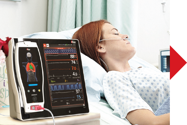 Masimo - Configurer les seuils d'alarme - femme étendue sur un lit d'hôpital avec un appareil