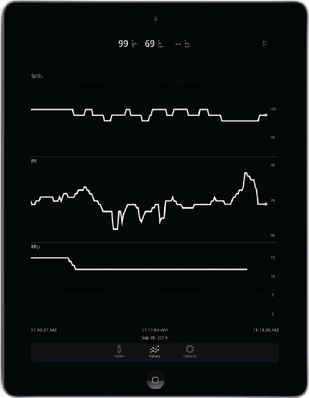 Masimo – Données relatives aux tendances sur l’application Masimo Professional Health