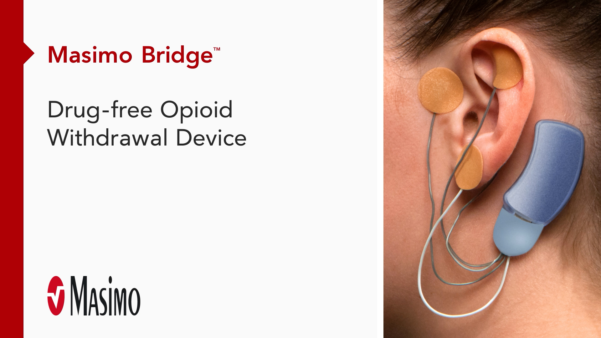 Présentation : Dispositif de sevrage des opioïdes sans médicament Masimo Bridge