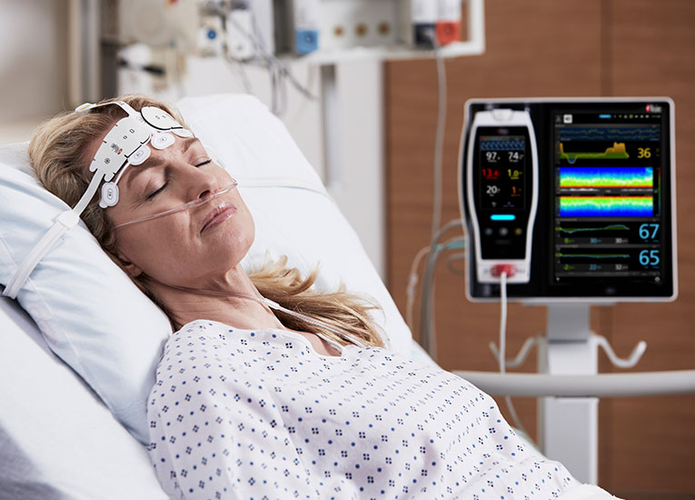 Masimo – Root avec O3 SedLine rainbow Lite ISA NomoLine