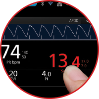 Rad-97 monitor with customizable display showing key patient data for quick assessment.