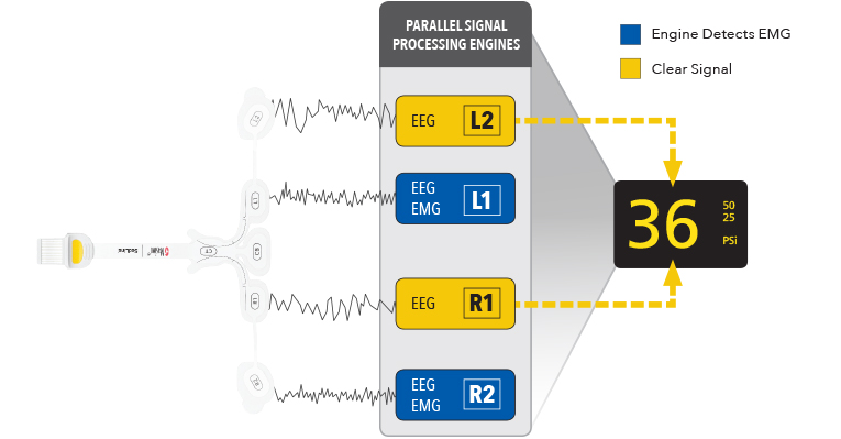 Masimo - Moteurs de traitement du signal en parallèle