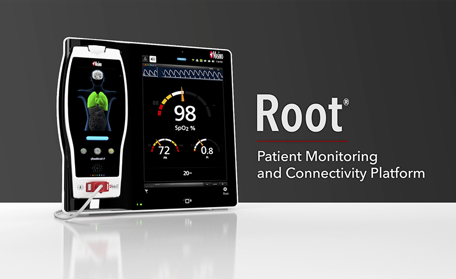 vignette de vidéo d’une vidéo Root