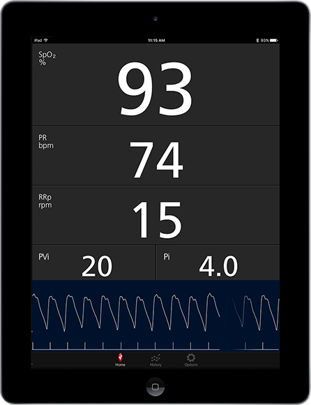 Masimo – Mesures affichées sur l’application Masimo Professional Health