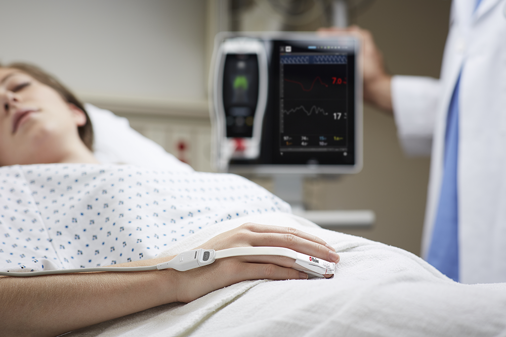 Patient endormi sur un lit d’hôpital portant un capteur Masimo sur le doigt et un dispositif Masimo Root à l’arrière-plan.