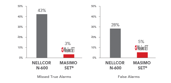 Masimo - Fiabilité des alarmes avec les performances de l’extraction du signal en cas de mouvements et de perfusion faible